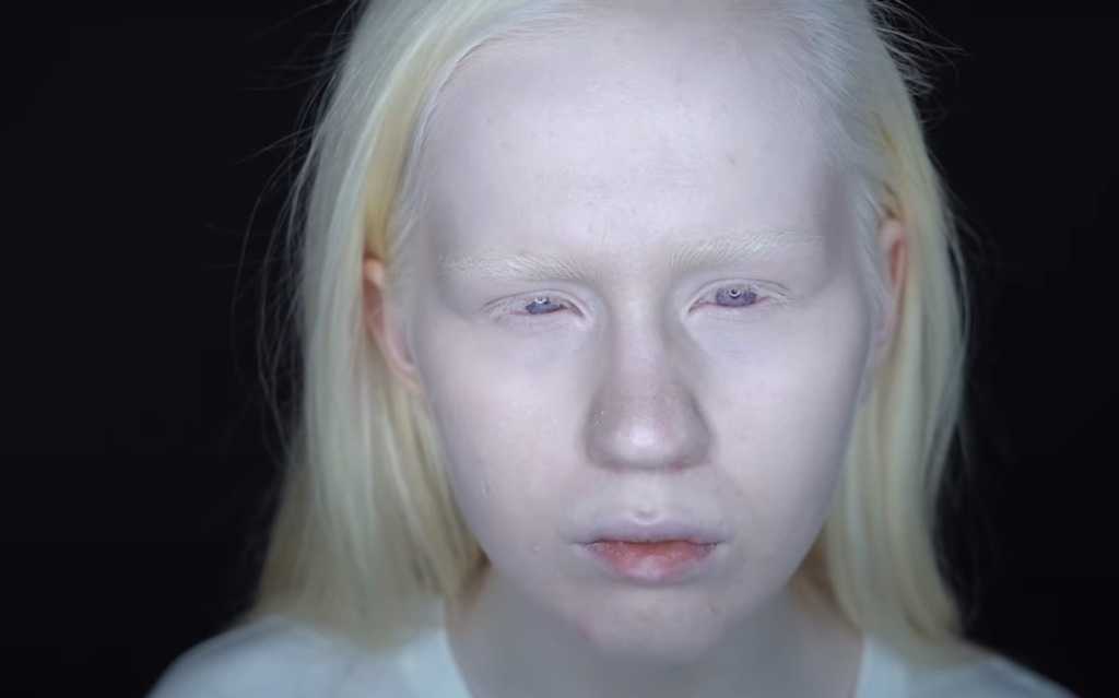 Альбиносы люди фото без фотошопа
