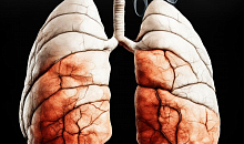 Доктор Лукин объяснил, что вызывает рак легких у пассивных курильщиков