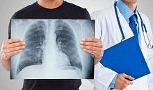 На Южном Урале снизилась заболеваемость туберкулезом